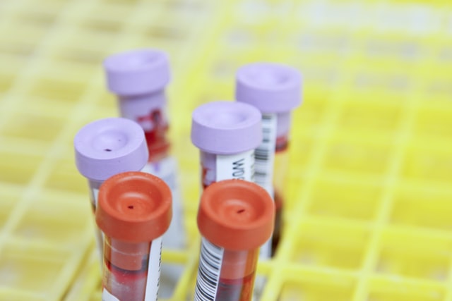 plastic tubes used for blood test in all ages including one-year-olds